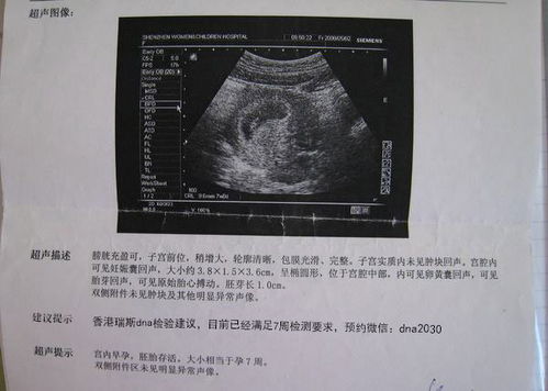 准爸爸手拿宝宝B超单要压岁钱